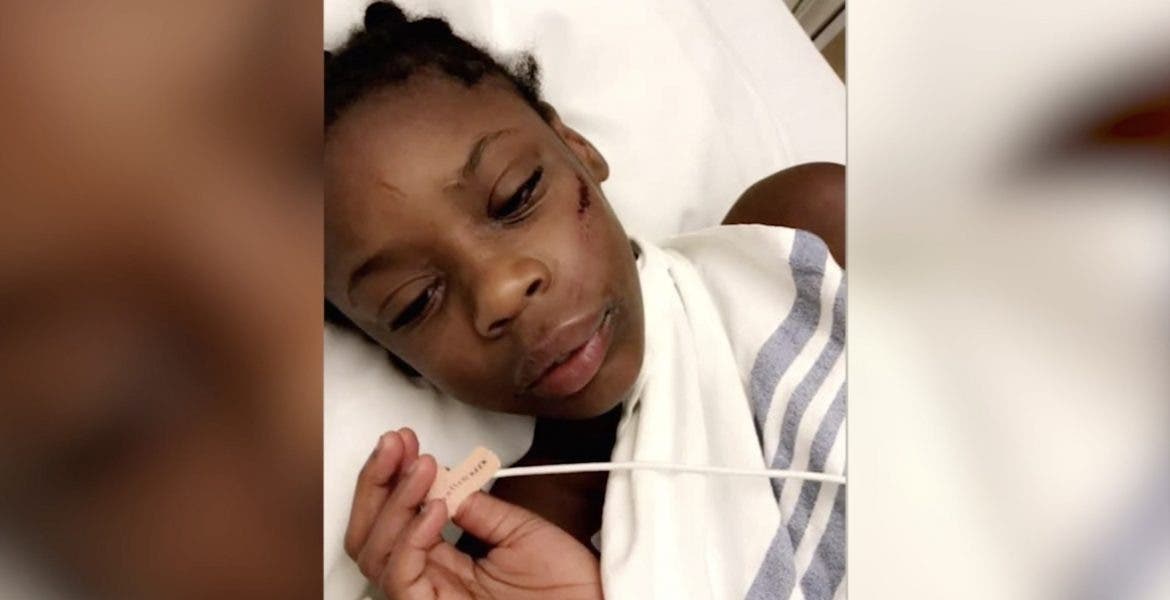 Black child badly beaten by bully for responding “Black is beautiful ...